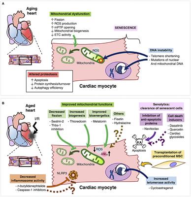 Potential Therapies to Protect the Aging Heart Against Ischemia/Reperfusion Injury